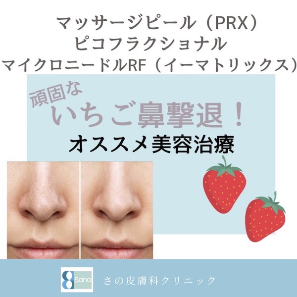 いちご鼻や毛穴の黒ずみの治療・マッサージピール（PRX）✨