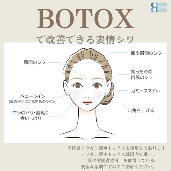 ボトックス注射✨️