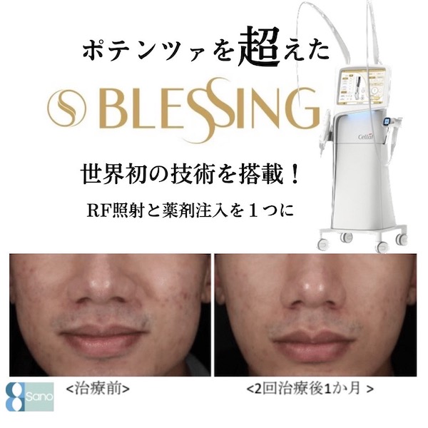 🆕✨ ポテンツァ超えのブレッシング！