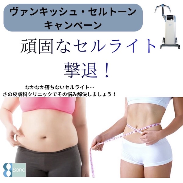 ヴァンキッシュ・セルトーンで頑固なセルライトを除去🧹🪣🧽